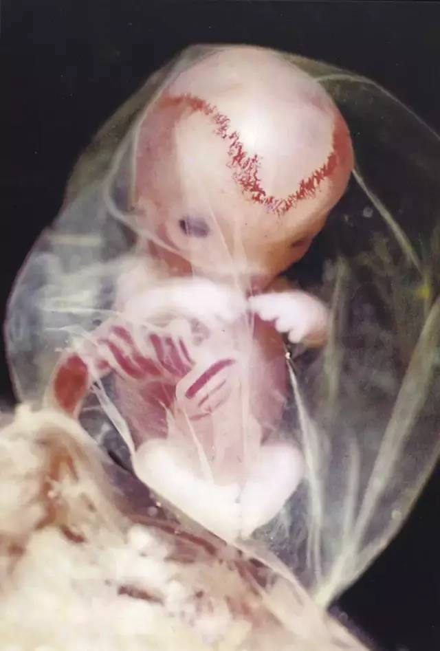 摄影师12年时间记录胎儿形成发育过程 极其珍